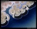 Streptomyces coelicolor on Mueller-Hinton agar